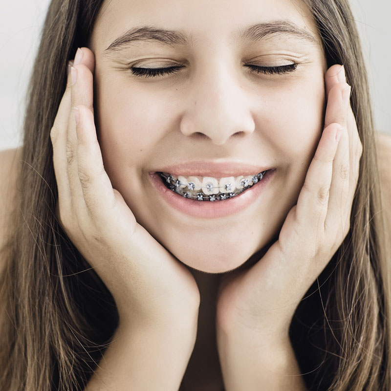 Braces: The Tried and True Method